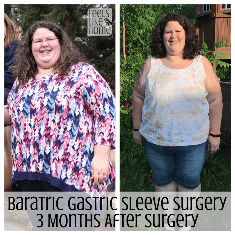 before and after weight loss photos with the title "bariatric gastric sleeve surgery 3 months after surgery"