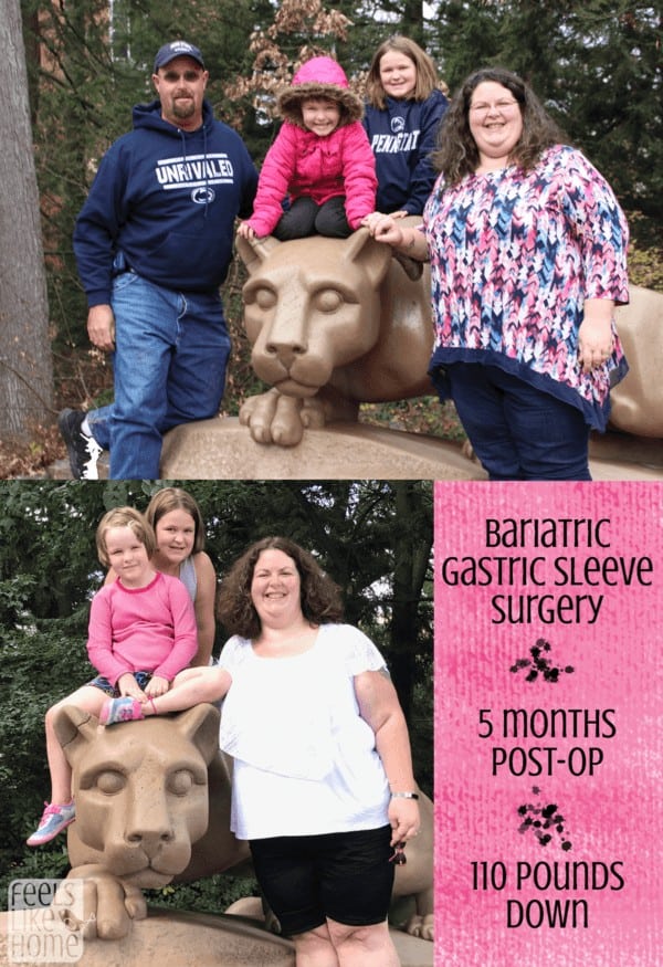 Tara Ziegmont and her family posing for a photo before and 5 months after bariatric surgery
