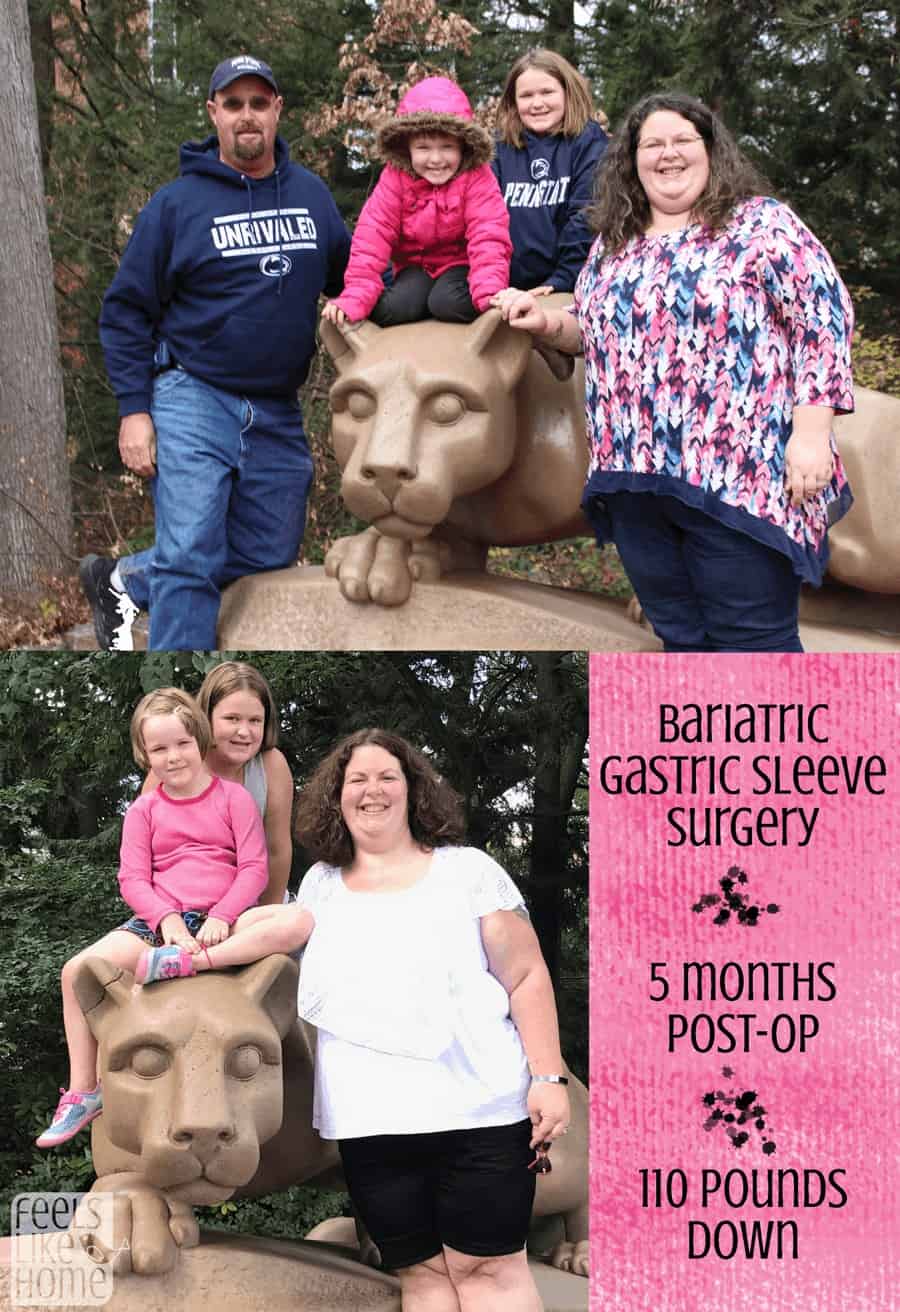 before and after weight loss photos with the title "bariatric gastric sleeve surgery 5 months post-op"