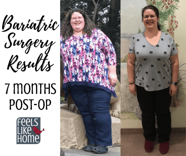 Bariatric Gastric Sleeve Surgery - 3.5 Months Post-Op - Feels Like