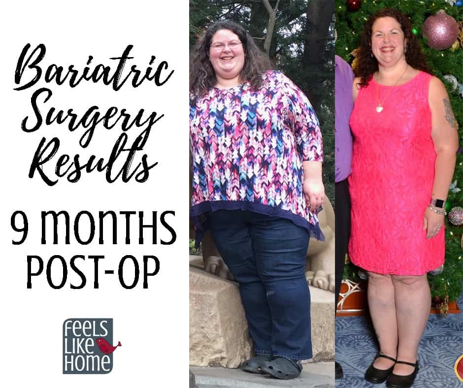 before and after weight loss photos with the title "Bariatric surgery results 9 months post-op"