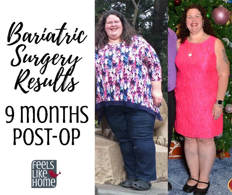 Gastric Sleeve Update - 3 Months Post-Surgery 