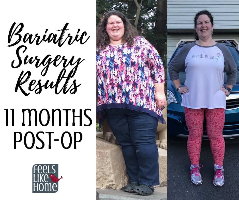 before and after weight loss photos with the title "Bariatric surgery results 11 months post-op"